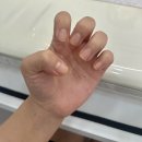 아화네일