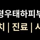 은평우태하피부과의원 네이버블로그