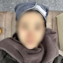 세브란스피부과의원 | (상봉피부과) 윤곽과 탄력을 동시에 관리하는 온다리프팅 60kj 후기