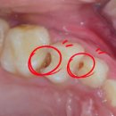 고은이치과의원 | 율전동 소아치과, 우리 아이 치과 찾고 계세요?