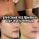 힐링 하우스 | 김해에스테틱 힐링하우스, 얼굴짧아지는법 관리 실제 후기