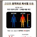 노벨의료기 네이버블로그