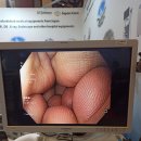 BS메디칼 이미지