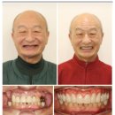 참 치과기공소 | 태평역치과? 임플란트 앞두고 있다면 <필독>