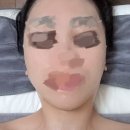 청량리 피부관리 올가스킨닥터에서 맞춤형 피부관리 제로필 데콜테 후기