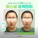 테르미에스테틱 대전도안점 | [도안동 테르미 에스테틱] 내돈내산 윤곽맛집 광대축소 / 저 성인인데 광대뼈가 움직일 수 있었나요..?