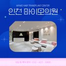 오쿠다디테일 | 부천 모발이식병원 추천 받았다면 5가지 체크해 보세요