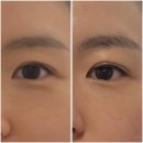 수피아스킨케어 | [수피아스킨앤바디] 조치원 윤곽관리, 무조건 작아져요!!진짜!