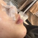 부산진구 피부학교 / 아프지않은 엑소좀 장벽케어 전문 서면여드름피부 관리후기