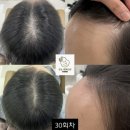 도노포레스타 두피케어(산본점)