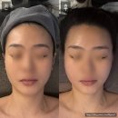 망우역1번출구 | 망우 피부관리 에스테티아 망우역점에서 윤곽관리 1회 관리전후 효과