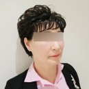 우리의원 | 청담아르티의원 레디어스 받고 우리 엄마 팔자 주름 달라진 리얼 후기