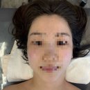 미셀 - 성남시 분당구 성남대로 151 | 내돈내산 포항 양덕동 마사지샵 피부 관리샵 얼굴 관리샵 피부과 후기 이루미셀뷰티 얼굴소멸핏+루미온다