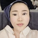 봄날의 젊음을 되찾아주는!! 내 피부의 봄!! 서산, 봄 클리닉의원!! 세르프 리프팅 후기