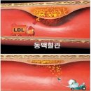 강황가루 다이어트 효과는 건강식품 강황가루의 효능 이미지