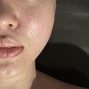엘에스빌딩 | 독산피부관리 엘에스아로마 스킨케어 환절기 수분관리 (feat. 턱피지)
