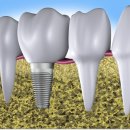 나란이치과의원 이미지
