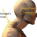 초등 필라테스 이미지