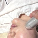태평양뷰티라인 | [부천 상동 피부관리]뷰티포톤피아 하이푸 후기! 브이라인, 여드름, 슈렉필, 문제성 피부 관리까지