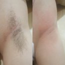 아리따운피부 이미지