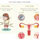 여자 왼쪽 아랫배 통증 이유 이미지