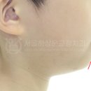분당퍼스트치과의원 네이버블로그