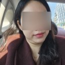 예쁠수밖개 | 얼굴지방흡입 후기 총정리 3탄: 한달~3달차 이중턱 변화 부작용