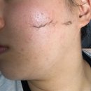 메디아 | 두정동 에스테틱 추천 스킨메디아에서 받은 스킨 플래닝 후기