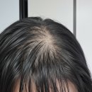 성일한방 | 닥터오레고닌 장민호 탈모샴푸추천 두피 자극 없이 시원해요