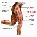 조프로짐 이미지