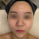 UR(파주시)-[와석순환로]-하-26 | 운정 피부관리 고온에스테틱 내돈내산 재방문 에어인 올인원 받고 수분 꽉 채운 후기