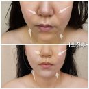해움에스테틱