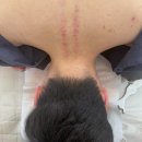 생활건강 테이핑&마사지 | 부산 체형 교정 광안리 마사지 다스리움