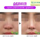 톡스미의원