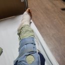 영주자인병원 | 영주 자인병원 반월상 연골판 파열 내시경 수술 후기