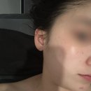 아이오마클리닉 | [선릉역 피부관리] 아이오마 클리닉 시그니처 케어 내돈내산 후기