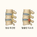 지산의원 네이버블로그