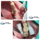 태양치과기공소 이미지