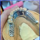 시온치과기공소 이미지