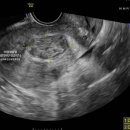 하산부인과의원 이미지