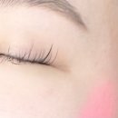 [대구 북구 피부관리] 대구 알테온 리프팅 받고 온 후기! 끌라르떼 에스테틱에서 경험한 탄력관리
