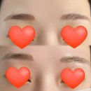 너에게반하다뷰티 | 너에게반하다(루이뷰티)에서 붉은 눈썹 잔흔제거 받고 왔어요