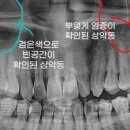 늘봄플란트치과 이미지