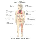 전신 홍반성 낭창[Systemic lupus erythematosus]기타 이미지
