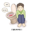 대장암에 대한 정의와 상식 이미지