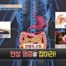 만성 염증 박멸 프로젝트! 최고의 국민 생선을 찾아라 [천기누설] 이미지