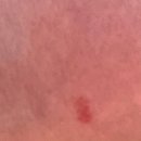 오즈피부과의원 이미지