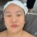 [아산 피부관리실] 스무살에 머물다 | 아산 에스테틱 추천! 1:1 프라이빗 케어 + 스킨플래닝 후기