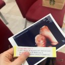 홍시약국 | 임신23주 기록 : 임당검사 후기(전주한나산부인과)