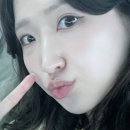 자연차 | ㅇㅁㄷ 자연유착 쌍수 4개월차 현실 후기 + 현재 상태 공개(붓기.라인.장단점.만족도 등)